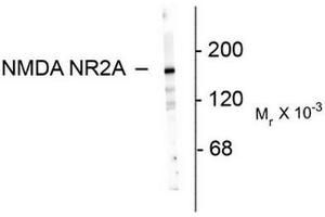 Image no. 1 for anti-Glutamate Receptor, Ionotropic, N-Methyl D-Aspartate 2a (GRIN2A) (N-Term) antibody (ABIN372681) (NMDAR2A antibody  (N-Term))