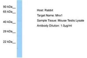 Image no. 1 for anti-Motor Neuron and Pancreas Homeobox 1 (MNX1) (AA 251-300) antibody (ABIN6749823) (MNX1 antibody  (AA 251-300))