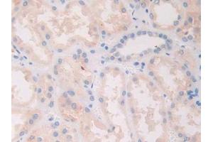 Detection of Slit1 in Human Kidney Tissue using Polyclonal Antibody to Slit Homolog 1 (Slit1) (SLIT1 antibody  (AA 647-835))