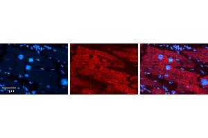 Rabbit Anti-CITED2 Antibody   Formalin Fixed Paraffin Embedded Tissue: Human heart Tissue Observed Staining: Cytoplasmic Primary Antibody Concentration: 1:100 Other Working Concentrations: N/A Secondary Antibody: Donkey anti-Rabbit-Cy3 Secondary Antibody Concentration: 1:200 Magnification: 20X Exposure Time: 0. (CITED2 antibody  (N-Term))