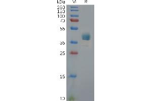 Human C Protein, hFc Tag on SDS-PAGE under reducing condition.