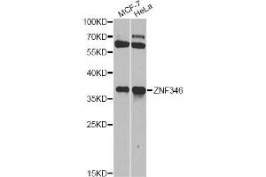 Western blot analysis of extracts of various cell lines, using ZNF346 antibody (ABIN5971759) at 1/1000 dilution. (ZNF346 antibody)