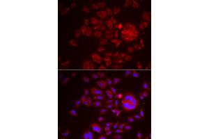 Immunofluorescence analysis of HeLa cells using SPINT1 antibody (ABIN6131743, ABIN6148359, ABIN6148360 and ABIN6222046). (SPINT1 antibody  (AA 234-513))