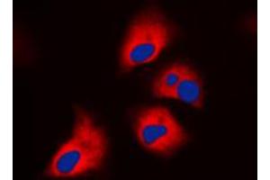 Immunofluorescent analysis of NF1 staining in HeLa cells. (Neurofibromin 1 antibody  (Center))
