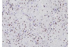 ABIN6276711 at 1/100 staining Human liver tissue by IHC-P. (NFATC1 antibody  (Internal Region))