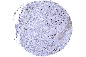IgA positive plasma cells are numerous in the tonsil (Recombinant Rabbit anti-Human IgA Antibody)