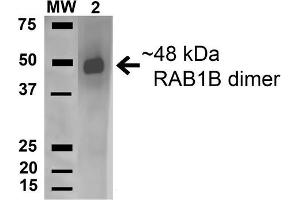 Western blot analysis of Human HeLa and 293Trap cell lysates showing detection of 22. (RAB1B antibody  (AA 179-189) (PerCP))