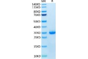 Human VSIG8 on Tris-Bis PAGE under reduced condition. (VSIG8 Protein (AA 22-263) (His tag))