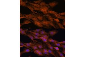 Immunofluorescence analysis of C6 cells using COMMD5 antibody (ABIN7266471) at dilution of 1:100.
