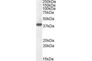 Western Blotting (WB) image for anti-Epilepsy, Progressive Myoclonus Type 2A, Lafora Disease (Laforin) (EPM2A) (Internal Region) antibody (ABIN335145)