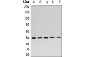 Western blot analysis of EEF1A2 expression in BT474 (A), MCF7 (B), mouse brain (C), mouse heart (D), rat skeletal muscle (E) whole cell lysates. (EEF1A2 antibody)