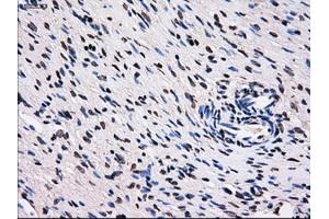 Immunohistochemical staining of paraffin-embedded colon tissue using anti-RPA2 mouse monoclonal antibody. (RPA2 antibody)