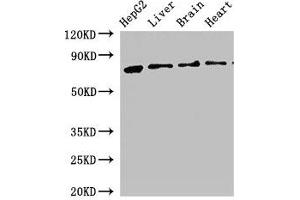 Western Blot Positive WB detected in: HepG2 whole cell lysate, Rat liver tissue, Rat brain tissue, Mouse heart tissue All lanes: KLKB1 antibody at 2. (KLKB1 antibody  (AA 503-612))