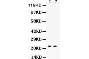 Observed bind size: 22KD (Lipocalin 2 antibody  (AA 21-200))