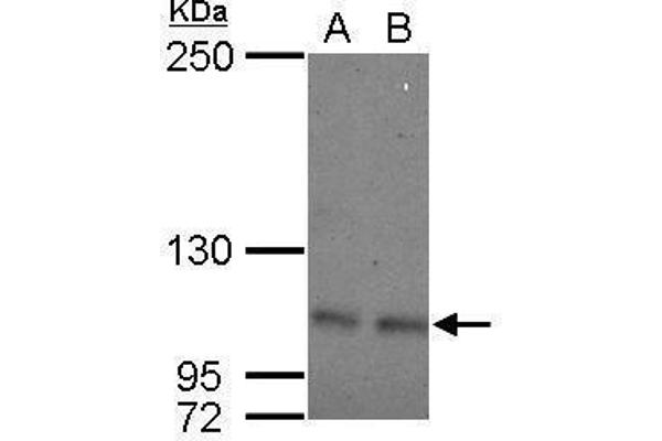 OCRL anticorps  (C-Term)