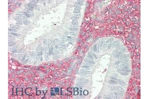 IHC-P analysis of Human Uterus Tissue, with HE staining. (Versican antibody  (AA 2958-3209))
