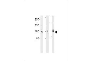 EPC1 Antibody (Center) (ABIN1881300 and ABIN2843438) western blot analysis in ,Hela cell line and mouse heart tissue lysates (35 μg/lane). (EPC1 antibody  (AA 305-334))