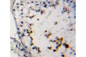 Used in DAB staining on fromalin fixed paraffin- embedded testis tissue (PRM2 antibody  (AA 2-100))
