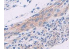 Immunohistochemistry (IHC) image for anti-Adenylate Cyclase 6 (ADCY6) (AA 314-501) antibody (ABIN7441871)