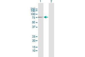 Western Blot analysis of IGF2BP2 expression in transfected 293T cell line by IGF2BP2 MaxPab polyclonal antibody. (IGF2BP2 antibody  (AA 1-598))
