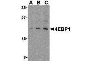 Western Blotting (WB) image for anti-Eukaryotic Translation Initiation Factor 4E Binding Protein 1 (EIF4EBP1) (C-Term) antibody (ABIN1030211) (eIF4EBP1 antibody  (C-Term))