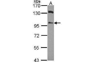 WB Image Sample (30 ug of whole cell lysate) A: A549 7. (ZAK antibody)