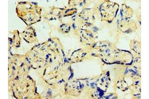 Immunohistochemistry of paraffin-embedded human placenta tissue using ABIN7148860 at dilution of 1:100 (CDK16 antibody  (AA 277-496))