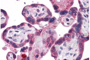 Human Placenta: Formalin-Fixed, Paraffin-Embedded (FFPE) (GPR32 antibody  (AA 1-15))