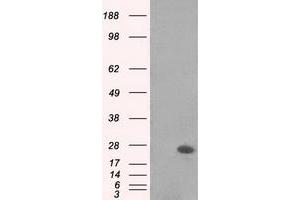 Image no. 1 for anti-MAD2 Mitotic Arrest Deficient-Like 1 (Yeast) (MAD2L1) antibody (ABIN1499249) (MAD2L1 antibody)
