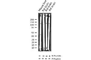 Western blot analysis of Phospho-HDAC4 (Ser632) expression in various lysates (HDAC4 antibody  (pSer632))