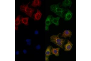 ABIN6266001 and ABIN6272794 staining Hela cells by IF/ICC.