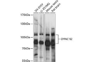 Western blot analysis of extracts of various cell lines, using DYNC1I2 antibody (ABIN7266862) at 1:1000 dilution. (DYNC1I2 antibody  (AA 352-612))