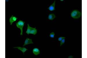 Immunofluorescence staining of MCF-7 cells with ABIN7145552 at 1:100, counter-stained with DAPI. (PAPSS2 antibody  (AA 2-138))