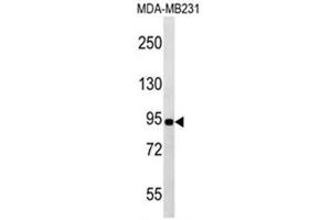 Western blot analysis of POU6F2 Antibody (N-term) in MDA-MB231 cell line lysates (35ug/lane). (POU6F2 antibody  (N-Term))