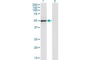 Western Blot analysis of PTGIS expression in transfected 293T cell line by PTGIS monoclonal antibody (M02), clone 3B11. (PTGIS antibody  (AA 391-500))