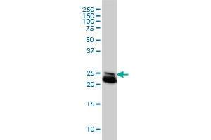 RAB21 monoclonal antibody (M01), clone 1F6 Western Blot analysis of RAB21 expression in HeLa . (RAB21 antibody  (AA 116-225))