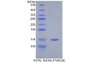 SDS-PAGE (SDS) image for Cystatin-Like 1 (CSTL1) (AA 21-114) protein (His tag) (ABIN1079333)