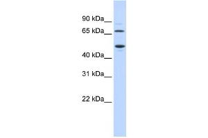 Western Blotting (WB) image for anti-Tryptophan 2,3-Dioxygenase (TDO2) antibody (ABIN2458954)