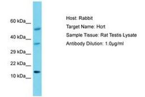 Image no. 1 for anti-Orexin (OX) (AA 45-94) antibody (ABIN6750422) (Orexin antibody  (AA 45-94))