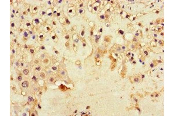 DNAH1 antibody  (AA 2225-2407)