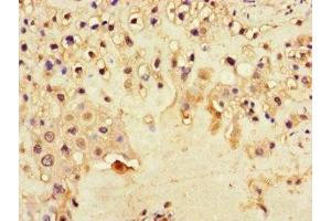 Immunohistochemistry of paraffin-embedded human placenta tissue using ABIN7150861 at dilution of 1:100 (DNAH1 antibody  (AA 2225-2407))