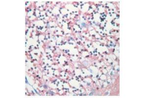 Formalin-fixed, paraffin-embedded human cerebellum stained with Anti-SNAP-25 ABIN119027 (SNAP25 antibody)