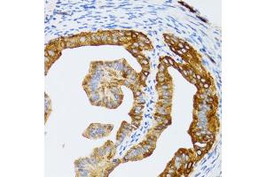 Immunohistochemistry of paraffin-embedded rat fallopian tube using CHAF1B antibody (ABIN5973690) at dilution of 1/100 (40x lens). (CHAF1B antibody)