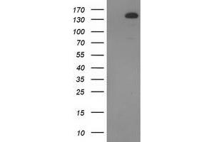 Western Blotting (WB) image for anti-TBC1 Domain Family, Member 4 (TBC1D4) antibody (ABIN1501319) (TBC1D4 antibody)