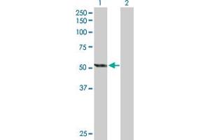 Western Blotting (WB) image for anti-Cytochrome P450, Family 2, Subfamily E, Polypeptide 1 (CYP2E1) (AA 1-493) antibody (ABIN514837)