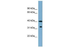 KCTD9 antibody used at 1 ug/ml to detect target protein. (KCTD9 antibody  (Middle Region))