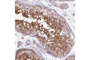 Immunohistochemical staining of human colon with MPP6 polyclonal antibody  shows strong cytoplasmic positivity in glandular cells.