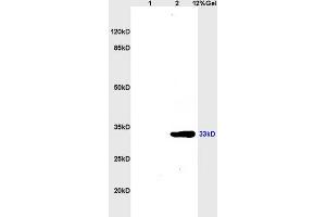 Lane 1: mouse brain lysates Lane 2: mouse kidney lysates probed with Anti CDK4 Polyclonal Antibody, Unconjugated (ABIN671166) at 1:200 in 4 °C. (CDK4 antibody  (AA 241-303))