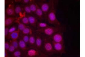 Immunofluorescence staining of methanol-fixed MCF cells using Progesterone Receptor(Phospho-Ser190) Antibody. (Progesterone Receptor antibody  (pSer190))