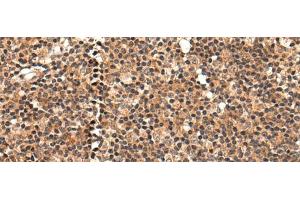 Immunohistochemistry of paraffin-embedded Human tonsil tissue using C16orf45 Polyclonal Antibody at dilution of 1:45(x200) (C16orf45 antibody)